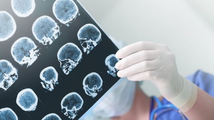 MRI AI detect tumor cell