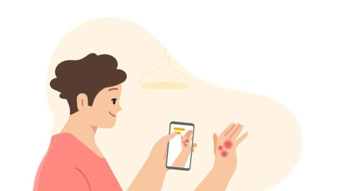 Google AI feature DermAssist identify skin conditions